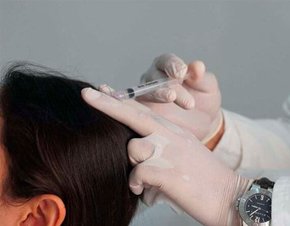 Restauración de Cabello con Células Madre en Cancún