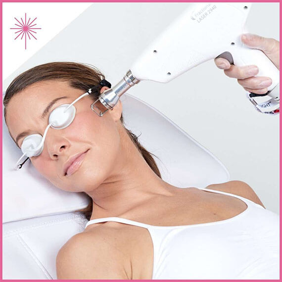 Fractional Skin Resurfacing Benefits Cancun